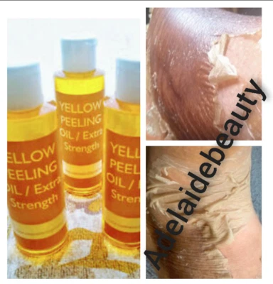 Aceite peeling amarillo extra fuerte Foto 1 de 4