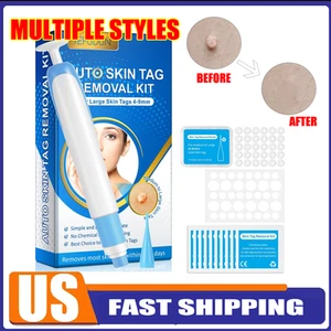 Auto Micro Skin Tag Remover Device Kit Safe Painless Removal Tool Multiple Style - Picture 1 of 18