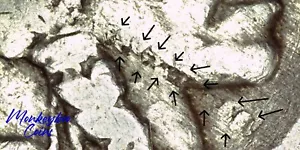 1936 Buffalo Nickel - Defective Planchet Lamination Obverse - Rare Mint Error - Picture 1 of 4