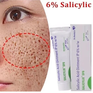 6% Salicylic Acid Acne Treatment Face Cream Remove Blackheads, Pores, Dark Spots - Picture 1 of 6