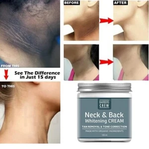 Dark Neck Skin & Back Lightening Cream - 100 gm Free Shipping - Picture 1 of 5