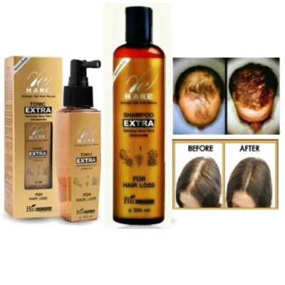 BIO WOMAN Hair Loss Shampoo Tonic Extra Strength Fast Growth New Regrow Treat - Image 1 of 4