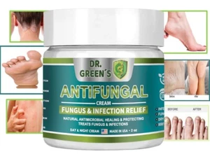 Natural Antifungal Cream support for Toenail Fungus Athletes Foot, Ringworm US - Picture 1 of 12
