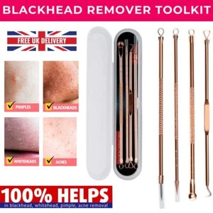 Acne Remover Blackhead Whitehead Facial Spot Pimple Popper Pore Tool Spike New - Picture 1 of 12