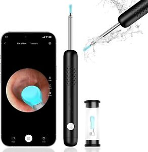 Ear Wax Removal Tool, Smart Ear Cleaner, Ear Camera Scope with Light
