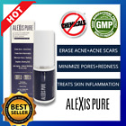 Alexis Pure Toco-Liftonin Arb Herbal Face Serum : Acne, Acne Scars & Pores