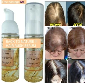 Grow Natural Gorgeous Hair Growth Density Serum Intense Hair Density in Weeks - Picture 1 of 12