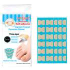 Ingrown Toenail Correction Tool Toe Nail Treatment Elastic Patch Sticker Clip
