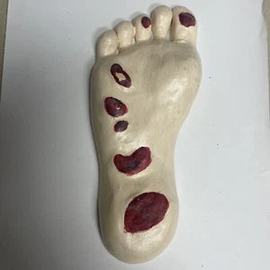 Vintage Foot Kaposi Sarcoma Anatomical Pathology Model - Picture 1 of 3