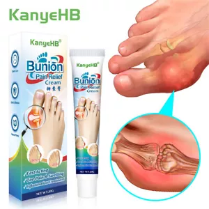 Bunion Pain Relief Cream Toe Joint Valgus Corrector Cream Treat Hallux Stiffness - Picture 1 of 7
