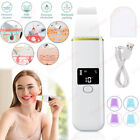 LCD Skin Scrubber Blackhead Peeling Remover Facial Face Care Pore Deep Cleaning