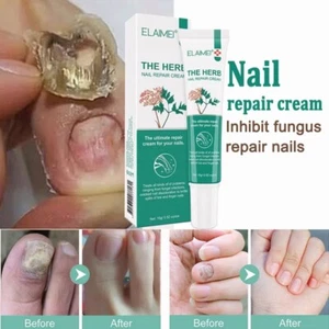 Nail Repair Cream 15g Quick repair damaged Nourishing nail anti crack ,fungal - Picture 1 of 9
