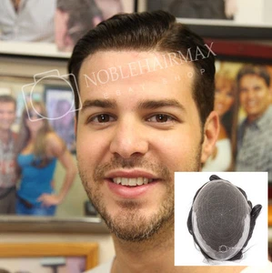High Hair Replacement System French Lace with Skin Mens Hairpieces Human Hair - Picture 1 of 71