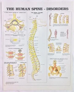 Impresión de libro de colección The Anatomical Chart Series 1988 The Human Spine - Disorders - Imagen 1 de 1