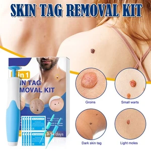 Kit de dispositivo removedor de etiquetas de micro piel 2 en 1 herramienta de banda de 2-8 mm para eliminación segura sin dolor - Imagen 1 de 18