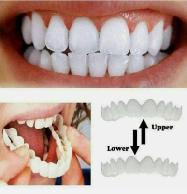 HOLLIWOOD SMILE 2 full sets Top & Bottom Veneers 2 Full Sets