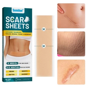 Sumifun Silicon Gel Scar Repair Patch GX - Picture 1 of 15