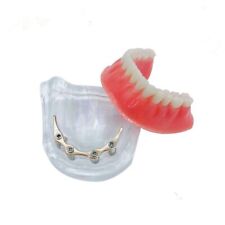 Overdenture Denture Teeth Mandibular Model with Golden Bar Dental Teaching Model