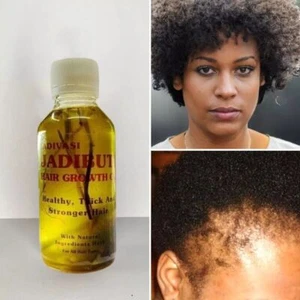 GROW YOUR HAIR FASTER LONGER Growth Oil for Handmade Hair Oil 100ml AUS FS - Picture 1 of 11