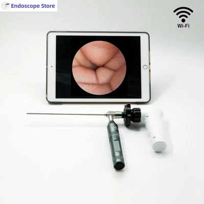 HD 1080P 60FPS WIFI Wireless Endoscope Camera Examination Surgery ENT Veterinary - Image 1 of 4