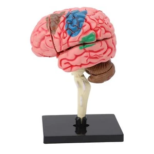 Gehirnmodell, Gehirnmodell im Querschnitt, anatomisches Modell des menschlichen - Bild 1 von 9