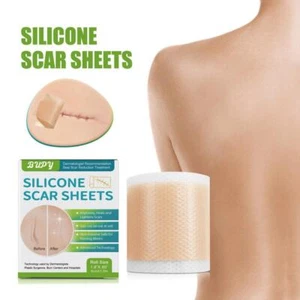 Scar Silicone Sheet Gel Patch Removal Skin Treatment Repair Wound Burn TOP NEW - Picture 1 of 14