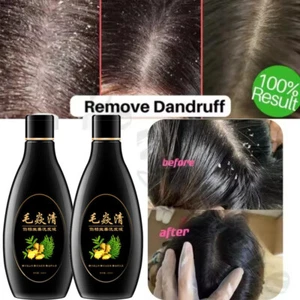 2024 Scalp Hair Follicle Shampoo Antibacterial Anti-Itching Mites Oil Control US - Picture 1 of 15