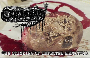 Coagulopathy - The Stinking Of Infected Hematoma 2018 Cass, Album, Ltd, Num  BNP - Picture 1 of 1