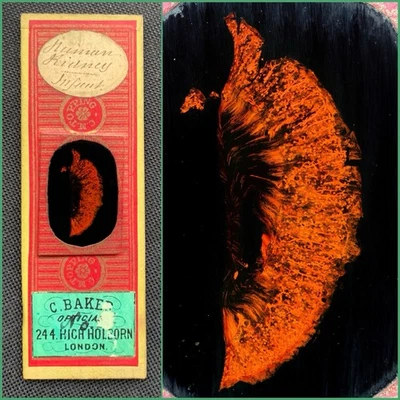 C.M.Topping Antique Microscope Slide. Injected Kidney of Infant - Image 1 of 3