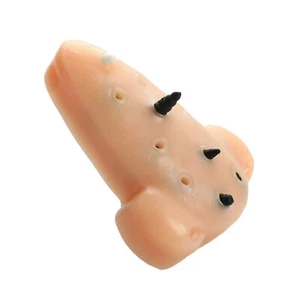 Acne Toy Recycled Blackhead Pimple Squeeze Stress Relief Remover Stop Funny Toys - Picture 1 of 11