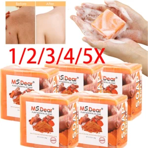 5/1x Tumeric Soap Skin Whitening Dark Spots lightening Acne Brightening Turmeric - Picture 1 of 22