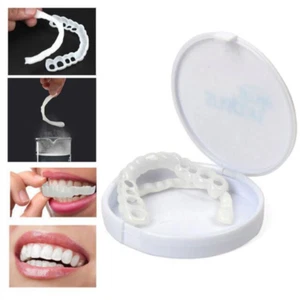 Denti finti in silicone Bianco da sovrapporre rimovibili e lavabili - Foto 1 di 5