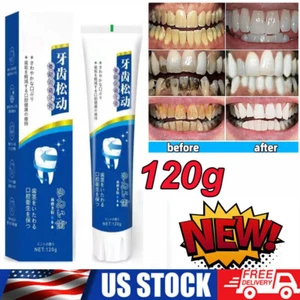 Upgrade Quick Repair of Cavities Caries Removal of Plaque Stains Toothpaste 120g - Picture 1 of 14