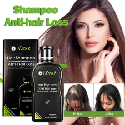 200ml Dexe Original Anti Hair Loss Shampoo Natural Herbal Hair Growth Treatment - Image 1 of 4