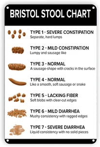X Ygstinsg Metal Tin Sign Nursing Student Gift Bristol Stool Chart Poop Toilet H - Picture 1 of 12