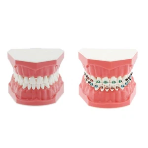 US Dental Typodont Brushing Flossing Practice Teeth Model with Metal Brackets   - Picture 1 of 36