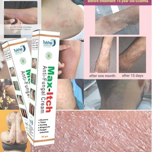 New Anti-Fungal  UNANI Treatment Max Fast Relief & Soothing Care Cream 30gm - Picture 1 of 3