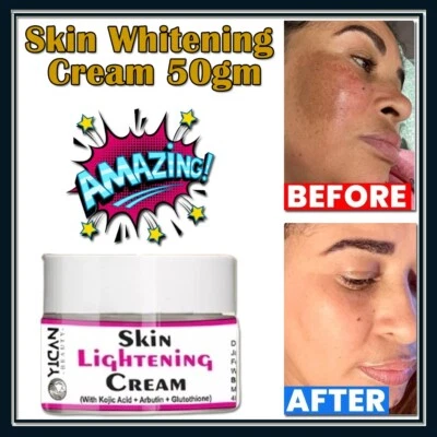 White Fade Super Skin Lightener Cream 1.7 oz - Image 1 of 4