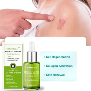 Advanced Scar Repair Serum For All Types of Scars Acne Marks GX Stretch R1Q1 - Picture 1 of 9