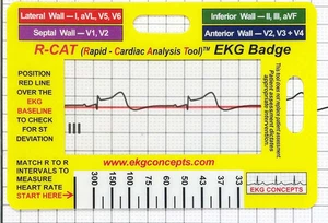 Insignia ECG - Imagen 1 de 11