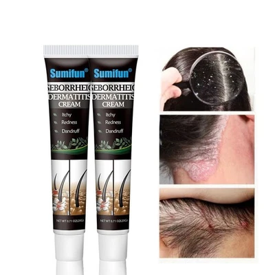 20G Seborrheic Dermatitis Care Head Itching Scalp Ringworm Repair Cream - Image 1 of 4