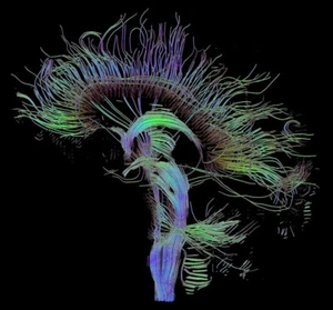 Impresión artística póster cerebro humano resonancia magnética imágenes tensor de difusión 24 x 24 pulgadas - Imagen 1 de 1