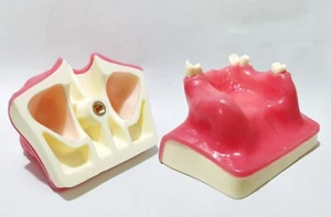 Dental Implant Maxillary Sinus Lift model Resin material Typodont Teeth - Picture 1 of 16