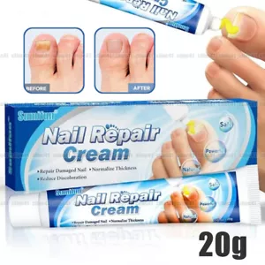 Crema antifúngica crema reparadora de uñas cuidado de uñas ungüento suave para uñas 20 g. - Imagen 1 de 11