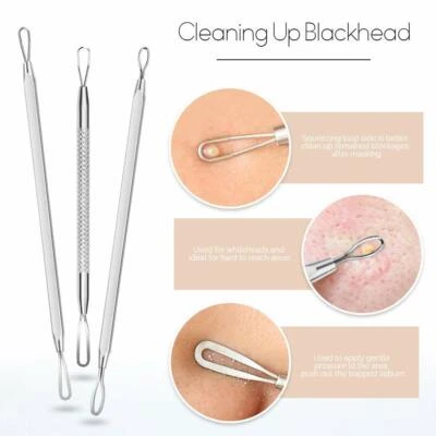 9x Blackhead Kit Blemish & Comedone Extractor Tools for Nose and Face Skin Care - image 1 of 4