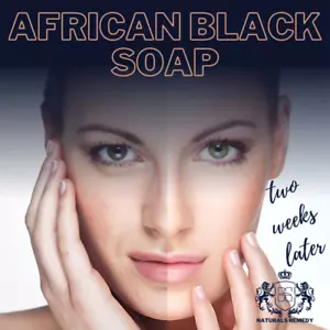 Black Soap Organic Authentic Raw African Ose Dudu Eczema Acne Fungus Psoriasis - Picture 1 of 5
