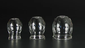 3er med. Feuer- Schröpfset 30-50mm, Schröpfglas ,Schröpfgläser Lauschaer Glas - Bild 1 von 1