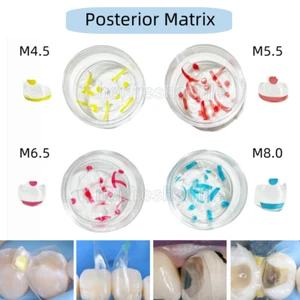 M4.5-M8.0 Dental Posterior Clear Matrix Restorative BT Bow Matrices Fit BioClear - Picture 1 of 13