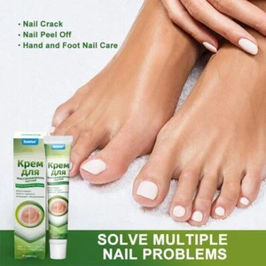 Nail Fungus Fungal Removal Cream Onychomycosis Treatment Infection Toenails New - Picture 1 of 9