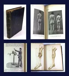 1895 ARCHIVIO ORTOPEDIA-Illustrated Italian Orthopedics Volume-Surgery, Medicine - Picture 1 of 8